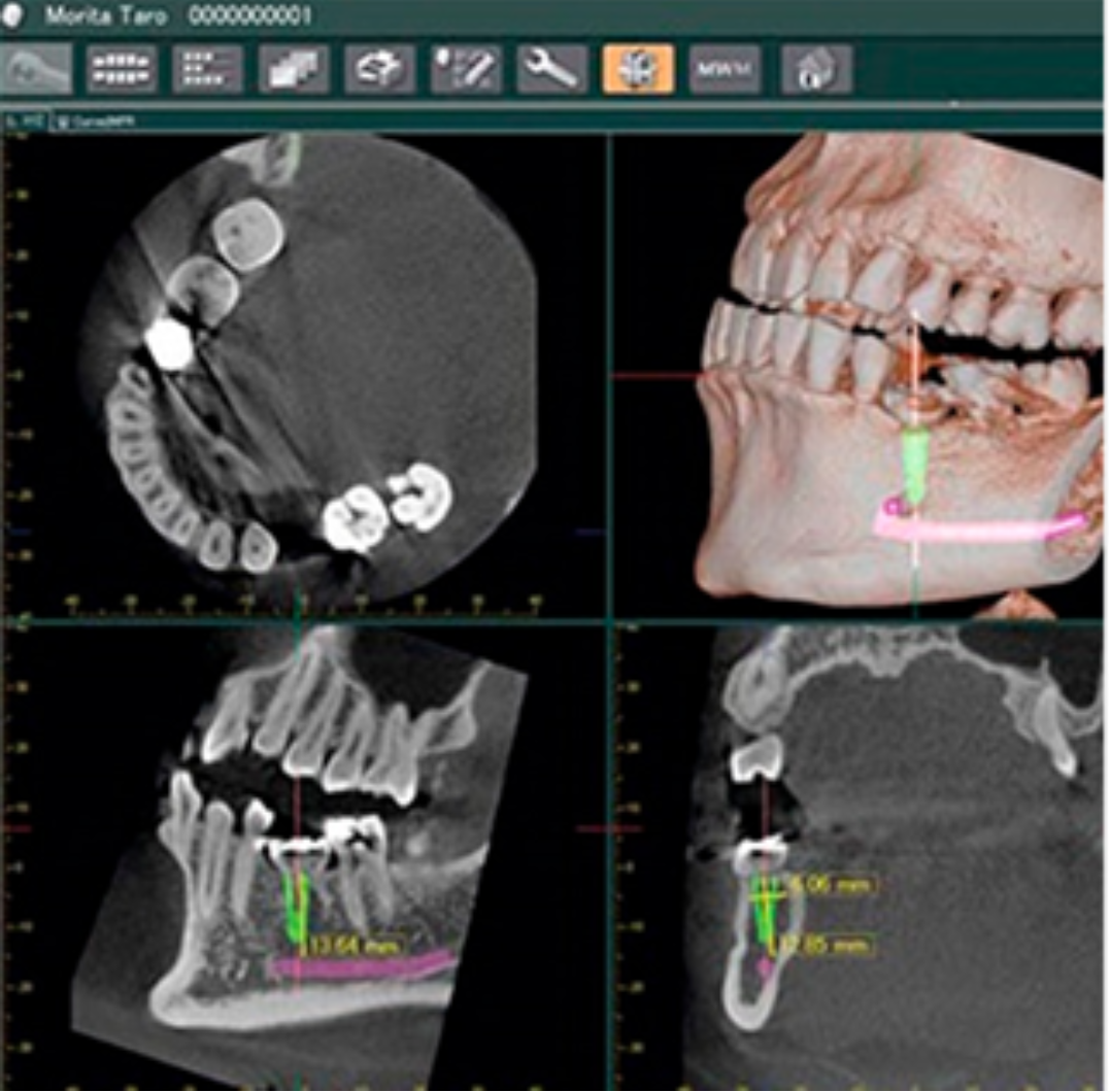 Equipo de ortopantomografía y radiología 3D de la clínica