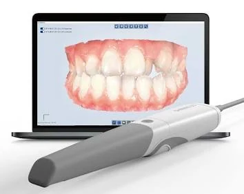 Escáner intraoral 3D mostrando el modelo dental en pantalla